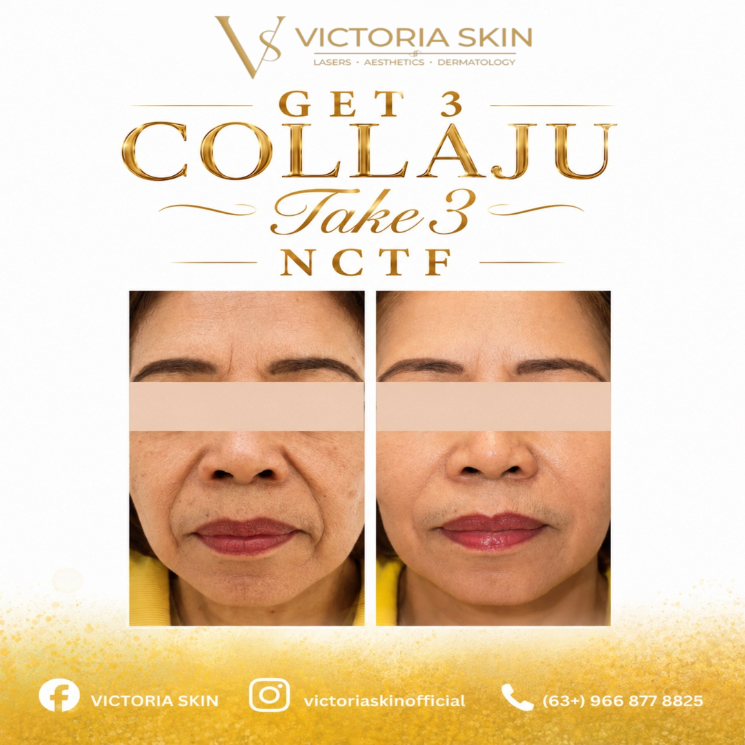 Victoria Skin promo 10